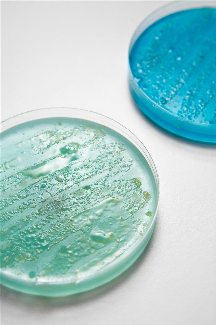 Interventi per Legionella
